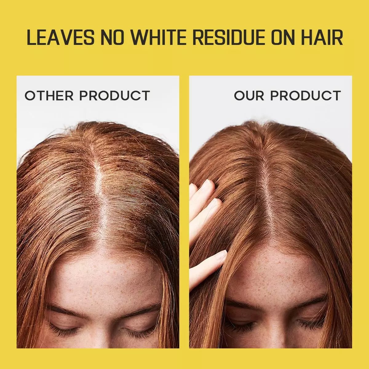 🔥2025 New Arrival🔥INSTANT FRESH VOLUMZING HAIR DRY SHAMPOO